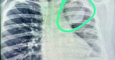 Joven con enfermedad pulmonar espera traslado