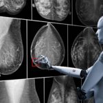 La inteligencia artificial que detecta tumores de mama invisibles para los médicos